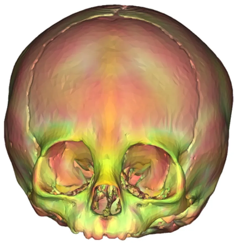 Reconstruction 3D d'un crâne