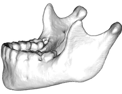 Croissance normale et pathologique de la mandibule